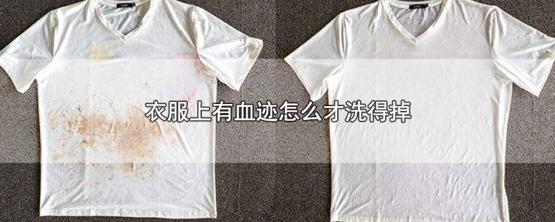 衣服上有血迹怎么才洗得掉